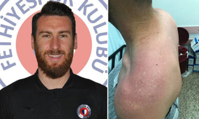 Fethiyespor’da darp iddiası