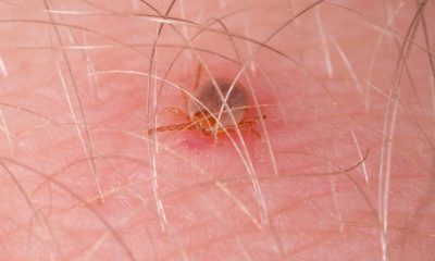 Kırım Kongo Kanamalı Ateşi’nde ölüm oranı yüzde 5