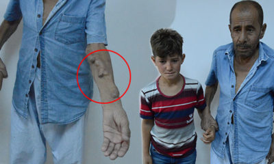 Hastalığının teşhisi için şehir şehir geziyor