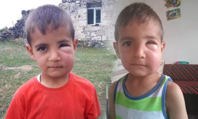 Arıların saldırdığı 2 çocuk hastaneye kaldırıldı