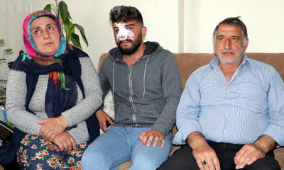 Yan bakma kavgasında yaralanan Ömer’in annesi: İzlediğim benim çocuğummuş