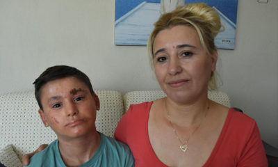Balık derisi hastası Kayra’ya kolilerce krem yardımı