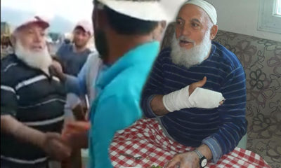 Pazarlık ederken müşterisinin parmaklarını kırdı