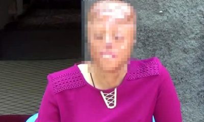 1,5 AYLIKKEN YÜZÜ YANAN LEYLA YENİ BİR YÜZ BEKLİYOR!.