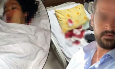 BİRİ BU ALÇAKLARA DUR DESİN: DOĞUM YAPMIŞ KARISINI HASTANEDE BIÇAKLADI!..