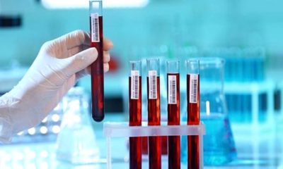 FAL DEĞİL BİLİM! 10 YIL İÇİNDE ÖLÜP ÖLMEYECEĞİNİZİ BİLİYORLAR!.