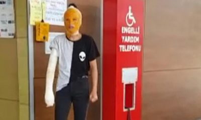 MISIR SATTIĞI ARABA YÜZÜNDEN YÜZÜ YANDI, TANINMAZ HALE GELDİ!.