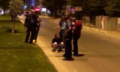 CANİ KOCA, BOŞANMA AŞAMASINDAKİ KARISINI BACAKLARINDAN VURDU!.