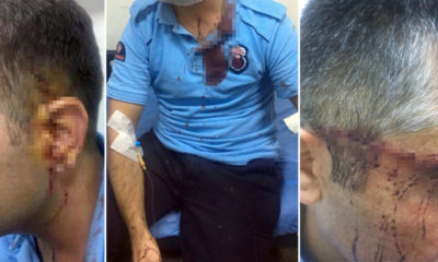 CEZAEVİNDE DEHŞET!. GARDİYANLARI BU HALE GETİRDİ!..