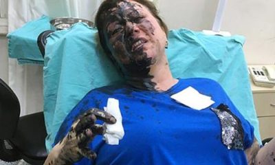DÖVÜP, SİYAH RENKLİ SIVI DÖKTÜLER!. NE OLDUĞU ARAŞTIRILIYOR!..