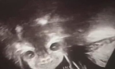 BEBEĞİN CİNSİYETİNİ ÖĞRENMEK İÇİN DOKTORA GİDEN KADIN HAYATININ ŞOKUNU YAŞADI!.