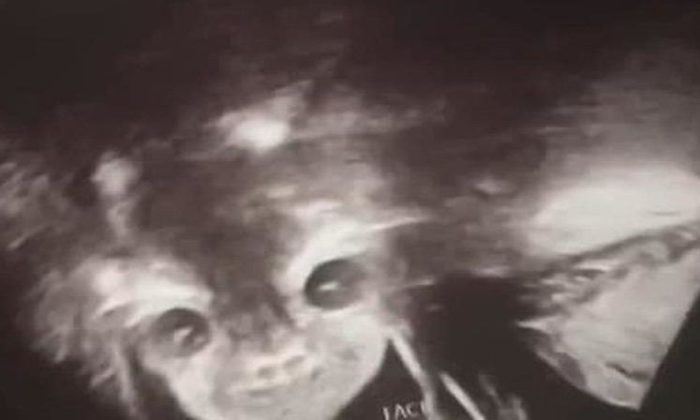 BEBEĞİN CİNSİYETİNİ ÖĞRENMEK İÇİN DOKTORA GİDEN KADIN HAYATININ ŞOKUNU YAŞADI!.