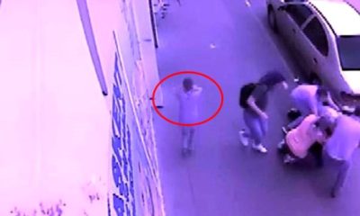 7 YAŞINDAKİ TALİHSİZ YAVRU HAYATI BOYUNCA BU VAHŞETİ UNUTAMAYACAK!.