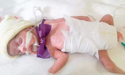 770 GRAM AĞIRLIĞINDA DOĞAN PARMAK BEBEK GÖKTUĞ 2 YAŞINDA!.