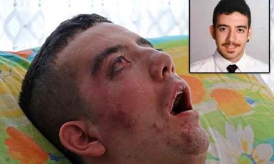 5 YILDIR GÖZLERİNİ KIRPAMAYAN GENCİN İÇLER ACISI HALİ YÜREKLERİ YAKTI!.