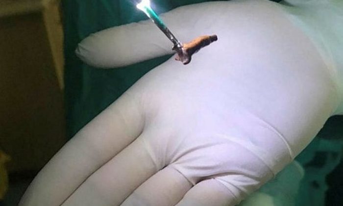 SOLUNUM GÜÇLÜĞÜ ÇEKİYORDU! AKCİĞERİNDEN KARANFİL ÇIKTI!.