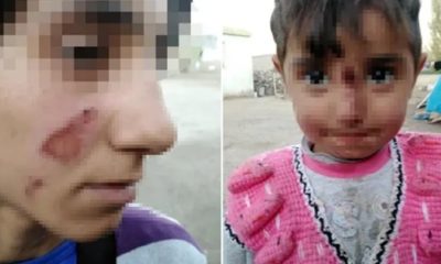 AĞRI’DA DEHŞET! CANİ ERİTTİĞİ NAYLONLA AİLESİNİ YAKTI!.
