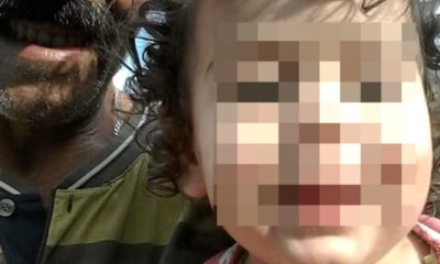 Kaynar suyun içine düştü, ertesi gün kahvaltı masasında fenalaşarak…