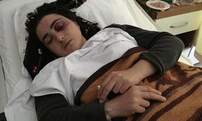 Eşinin şiddetiyle gözünü kaybeden kadın: “Dünyamı kararttı, ışığa hasret kalsın!.”