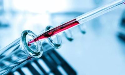 Rusya corona virüsüne karşı aşı geliştiriyor!.