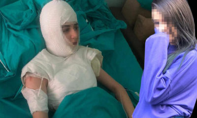 Üvey anne dehşeti!. Küçük kızın başından aşağı kaynar sular döken canavar anne mahkemede serbest bırakıldı!.