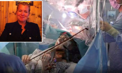 Tarihe geçen olay!. Ünlü sanatçı beyin ameliyatında keman çaldı!.