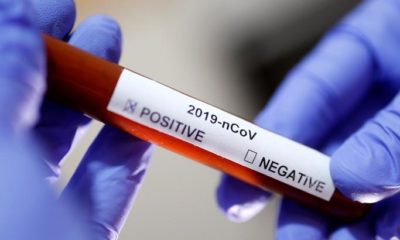 Dünya Sağlık Örgütü’nden coronavirüs kararı…