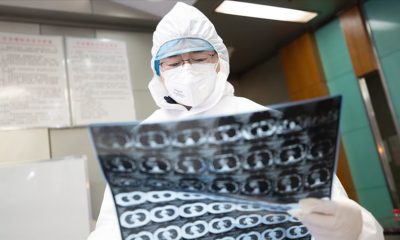 Koronavirüs nedeni ile ölenlerin sayısı 637’ye yükseldi!. 31 bin 161 kişi karantinaya alındı!.