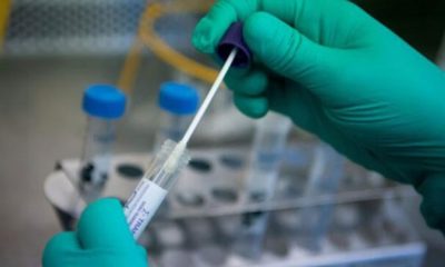 Ölümcül virüsü tespit edebilen test geliştirildi!.