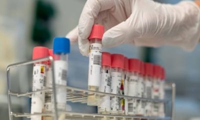 Havadan ve yiyeceklerden coronavirüs bulaşır mı?.