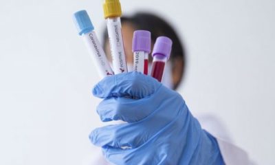 Online coronavirüs testi artık internette… Tıklayın sonucu öğrenin!.