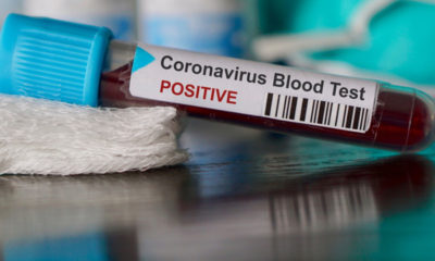 ABD’de Covid-19 araştırması: “Coronavirüs, SARS ve MERS kadar ölümcül değil…”