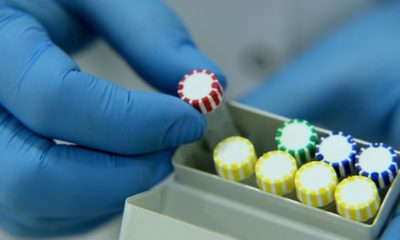 15 dakikada sonuç veren tanı kitinin kullanımına başlandı!.