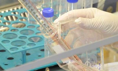 Sıtma ilacı coronavirüs tedavisinde işe yarıyor!.