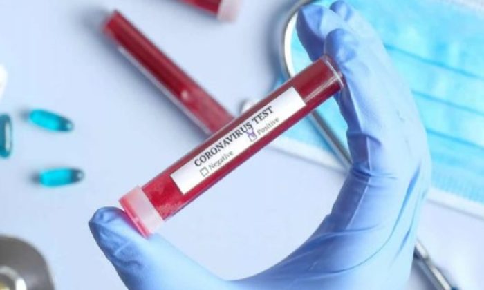 Çin’den “test kiti” açıklaması! “Sorun bizde değil sizde…”