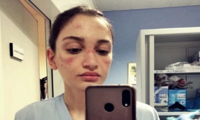 Evde kal Türkiye! Bizim doktorlarımız bunu yaşamasın!. İtalyan doktorların yüzlerinde maske yaraları oluştu!.