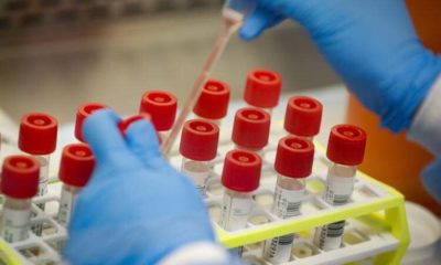 Yuh size!. Vatandaşın korkusunu fırsat bilip bedava yapılan koronavirüs testinden para aldıkları ortaya çıktı!.