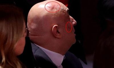 Kavga sonrası CHP’li Engin Özkoç’ta son durum…