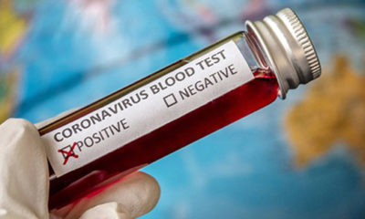 Rusya’dan flaş açıklama: Koronavirüs ilacını geliştirdik!.