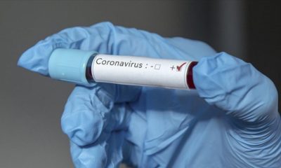 Türkiye’de ücretsiz olan corona testi, Amerika’da sigortası olana 600, olmayana 1500 dolar…