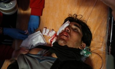 Yunan zulmü! Mültecinin gözünü çıkardılar!.