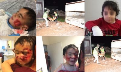 Sokak köpeklerinin saldırdığı 6 çocuktan biri hayatını kaybetti!.