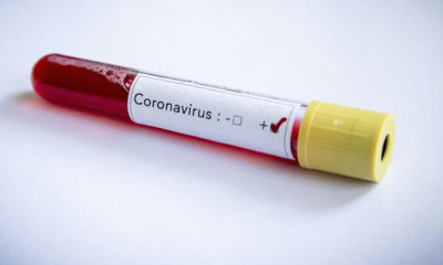 Bilim insanları koronavirüs ile ilgili korkunç gerçeği açıkladı!. “Buzdolabınıza…”