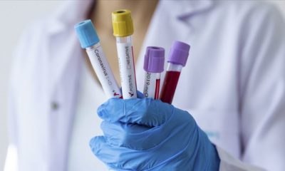 Son Dakika: Dünya Sağlık Örgütü’nden Türkiye açıklaması!. Korona aşısı için de tarih verdi!.