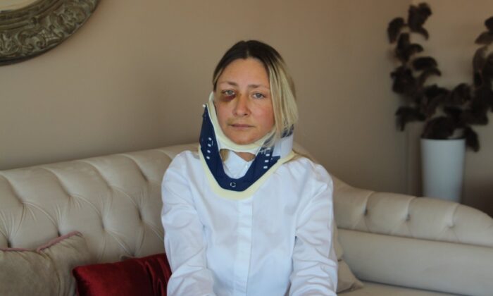 Kuşadası’nda saldırıya uğrayan banka müdürü konuştu!.