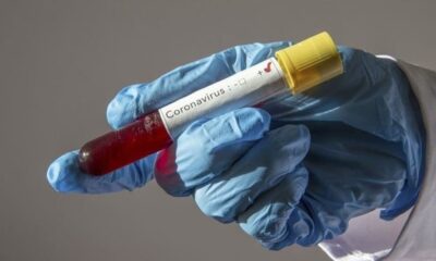 Kız isteme merasiminde corona dehşeti! 5 ev karantinaya alındı!.