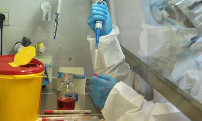 Bilim insanları virüsten en çok etkilenen kan grubunu tespit etti!.