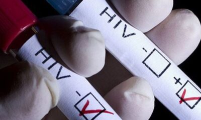 Coronavirüsten sonra AIDS alarmı! Vaka sayısı bine çıktı!.