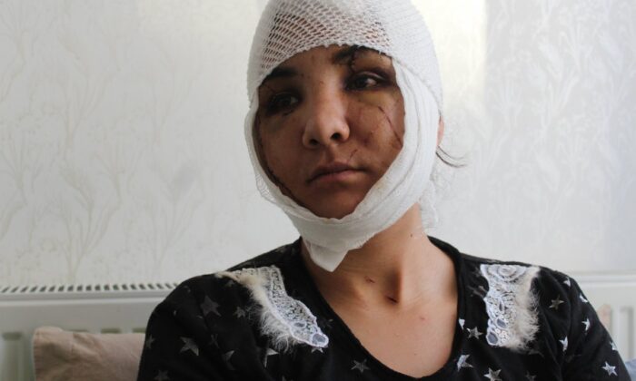 Gaziantep’te dehşet! 6 yıllık eşi tarafından yüzünden bıçaklandı!.