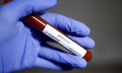 Bilim Kurulu Üyesi Çelik: “Türkiye’de bu yöntemle virüs ortadan kalkar ama 5 milyon kişi ölebilir!.”